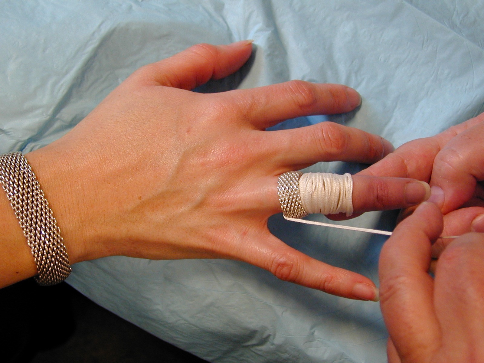 5 ways to remove a ring from a swollen finger